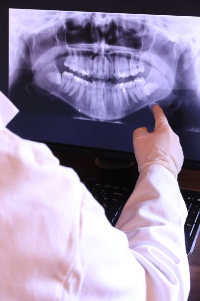 Best Emergency Treatment for Dental Infections or Abscesses in Sleepy Hollow, IL